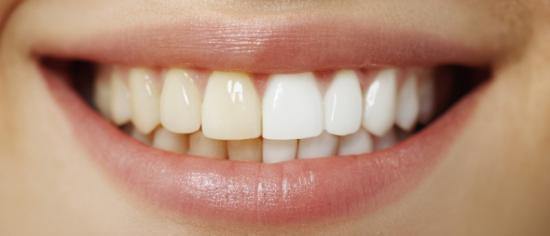 Traitement des dents