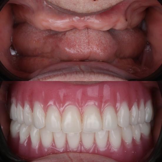 Le avant et l'après