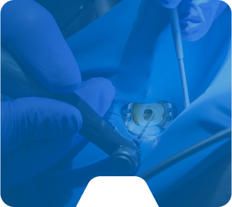 Traitements spécialisés